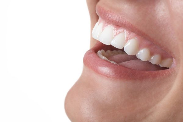 Primer plano de una sonrisa tras tratamiento de estética dental